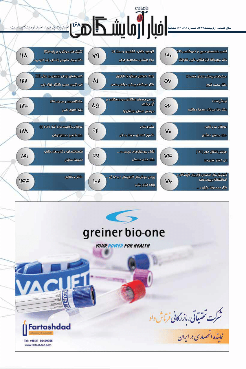 (PDF) Down Syndrome