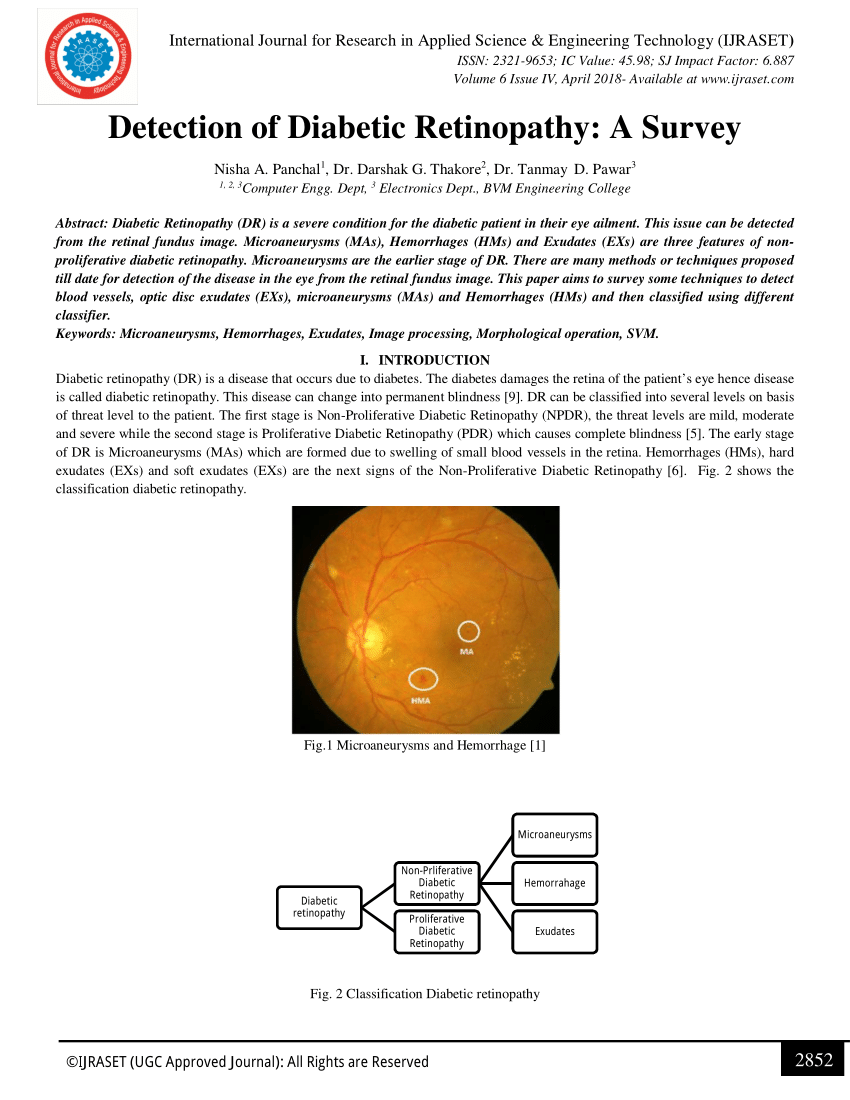 research articles on diabetic retinopathy