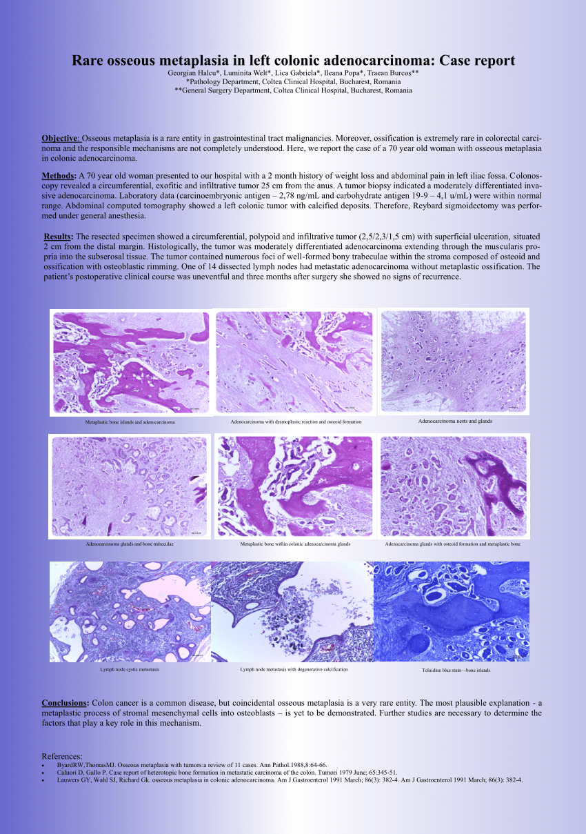 Pdf Rare Osseous Metaplasia In Left Colonic Adenocarcinoma Case Report 