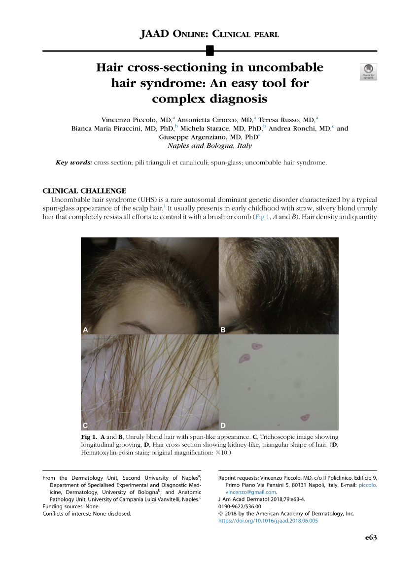 PDF) Hair cross-sectioning in uncombable hair syndrome: An easy tool for  complex diagnosis