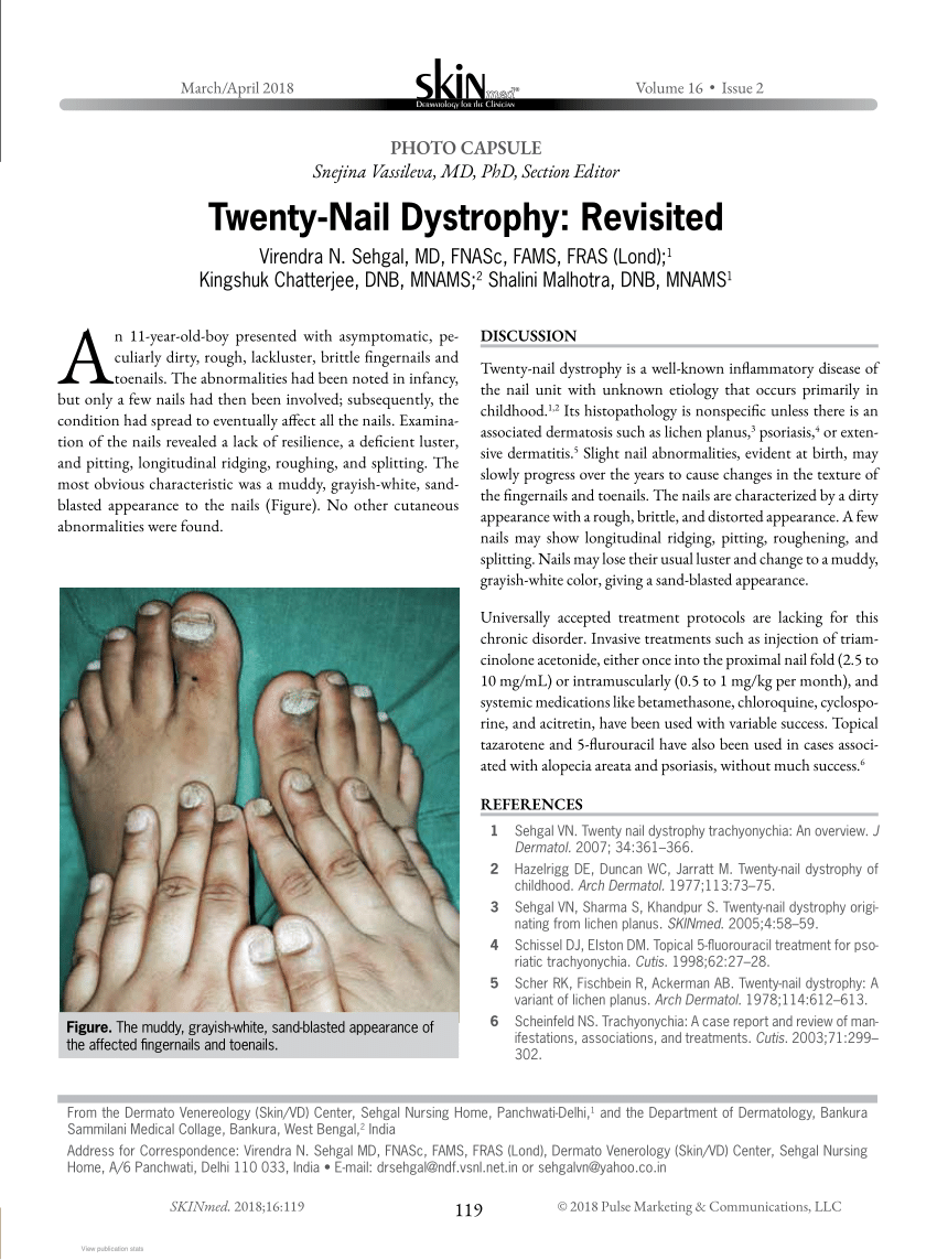 Figure 2 from Trachyonychia and Twenty-Nail Dystrophy: A Comprehensive  Review and Discussion of Diagnostic Accuracy | Semantic Scholar