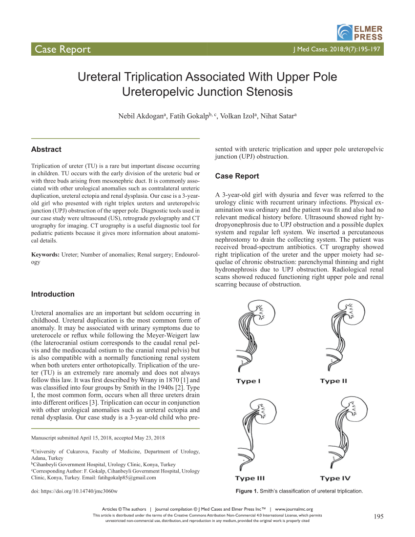 Pdf Ureteral Triplication Associated With Upper Pole Ureteropelvic Junction Stenosis 2661