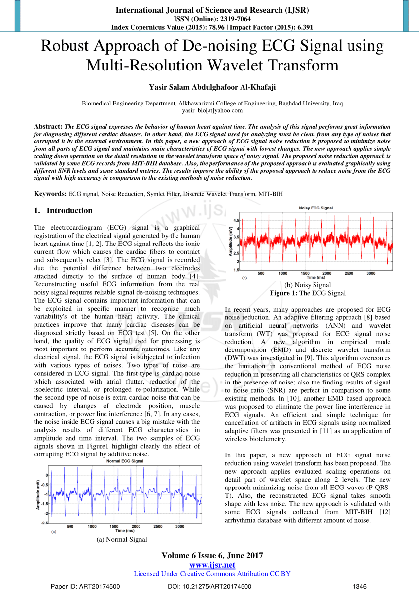 Pdf Robust Approach Of De Noising Ecg Signal Using Multi Resolution