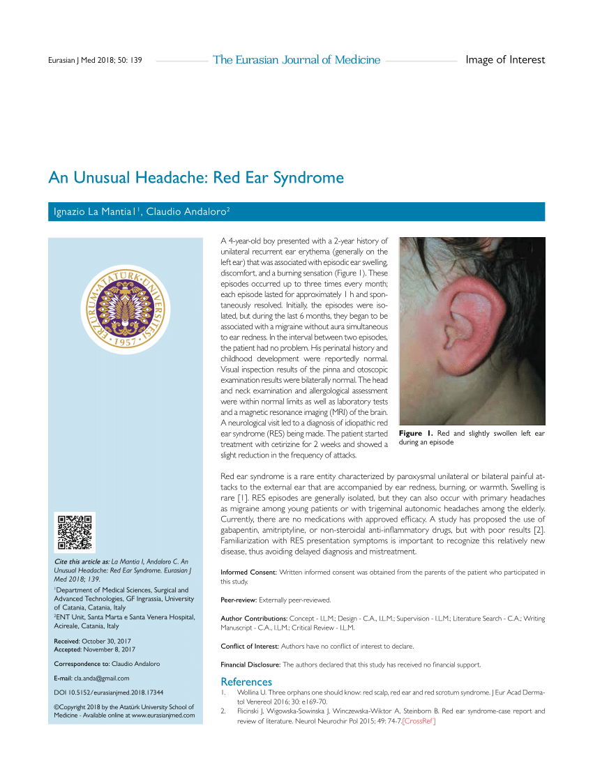 Pdf An Unusual Headache Red Ear Syndrome