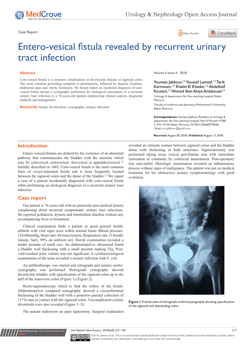 Infecțiile tractului urinar - Cauze, simptome și tratament