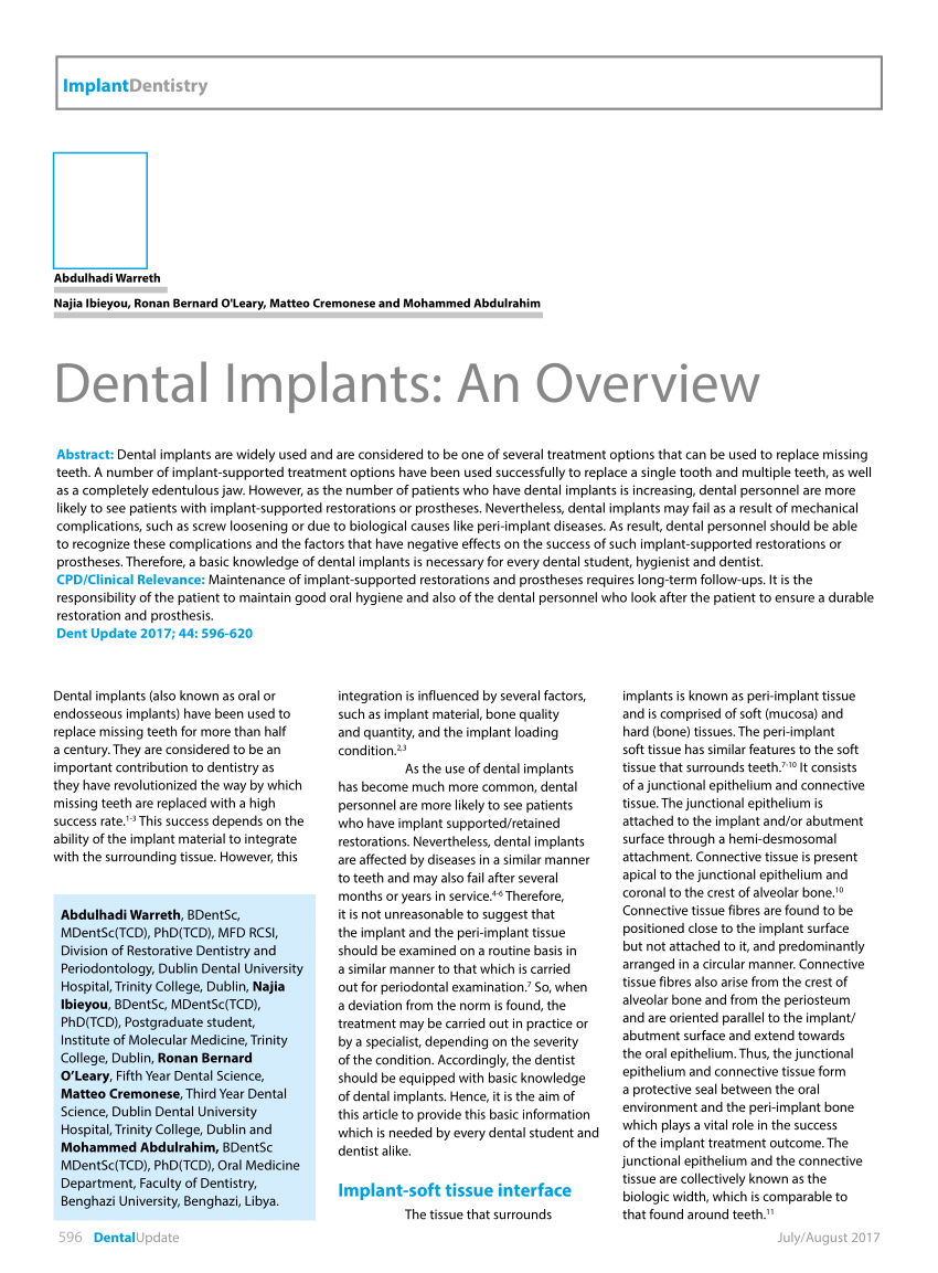research paper on dental implants