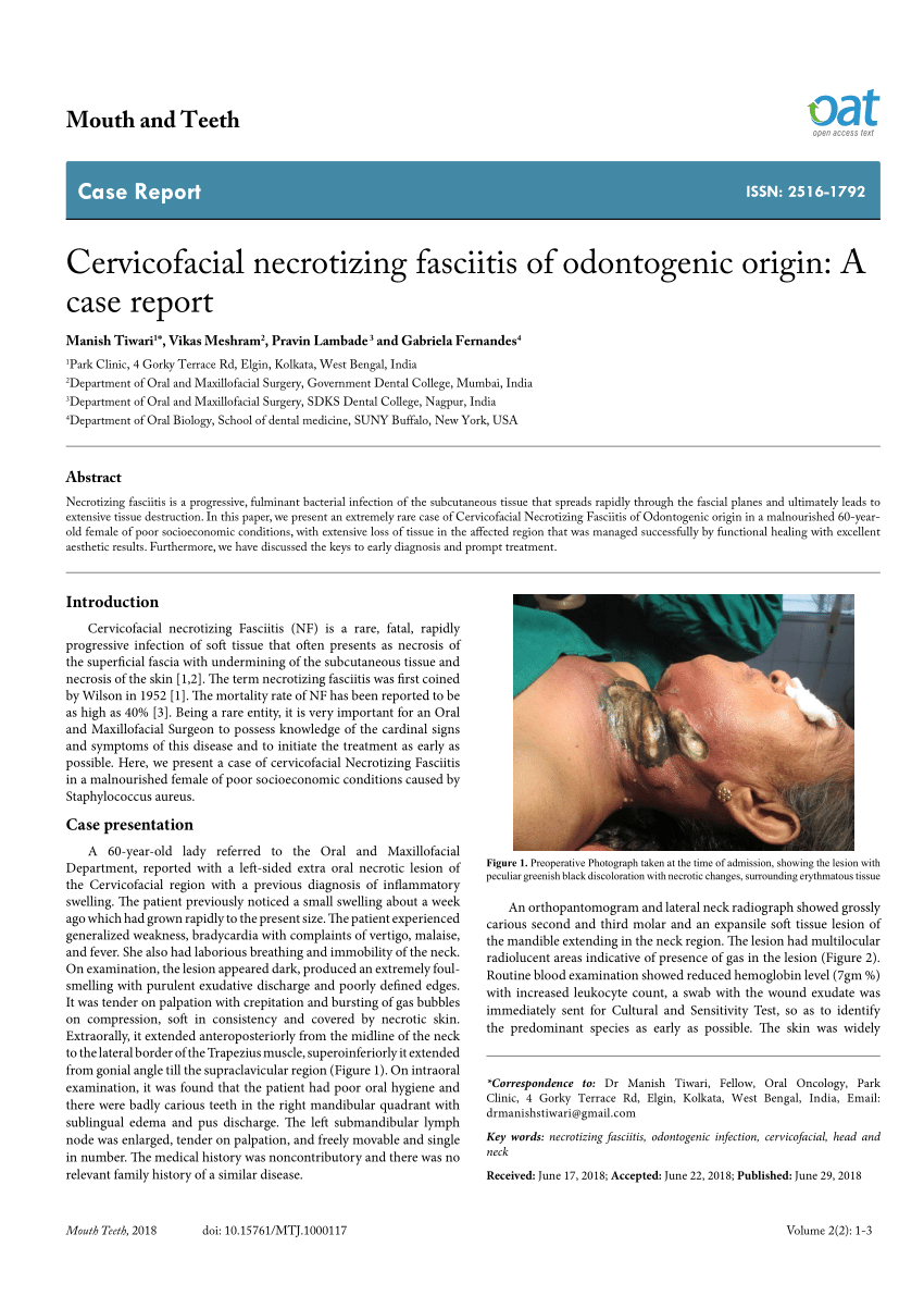 Pdf Cervicofacial Necrotizing Fasciitis Of Odontogenic Origin A Case Report