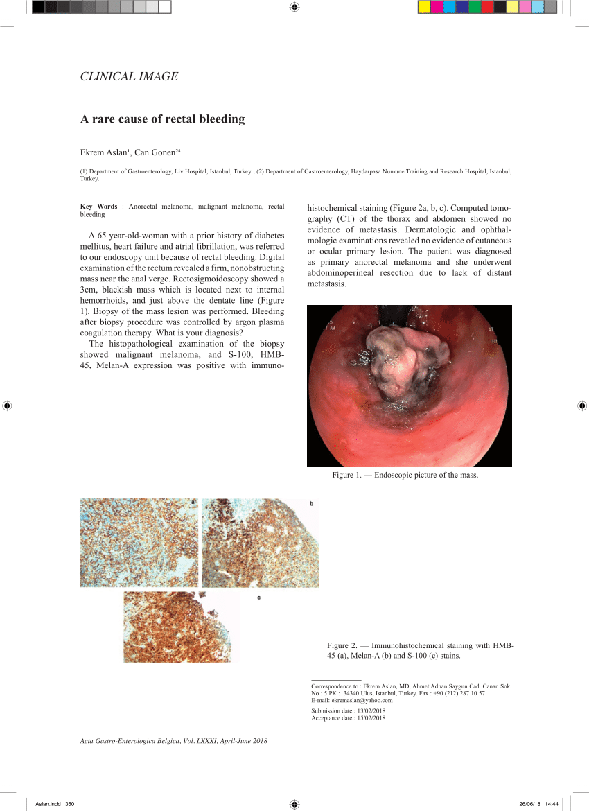 lincoln-surgical-associates-pc-what-can-cause-rectal-pain