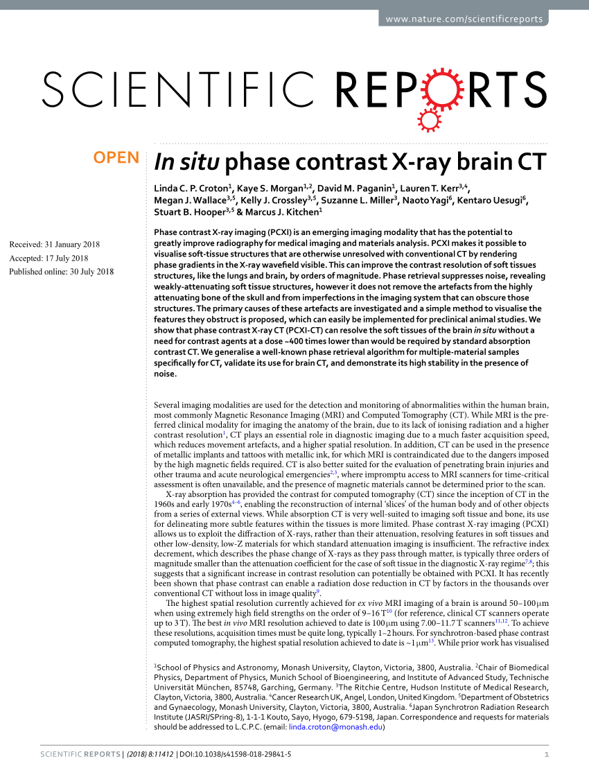 Pdf In Situ Phase Contrast X Ray Brain Ct