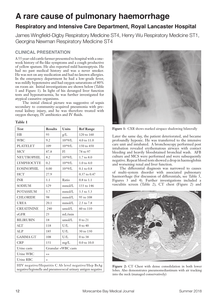 (PDF) A Rare Cause of Pulmonary Haemorrhage