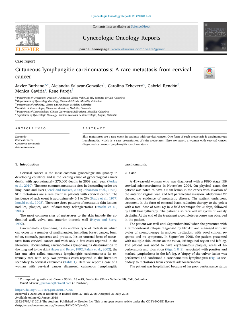 Pdf Cutaneous Lymphangitic Carcinomatosis A Rare Metastasis From Cervical Cancer 