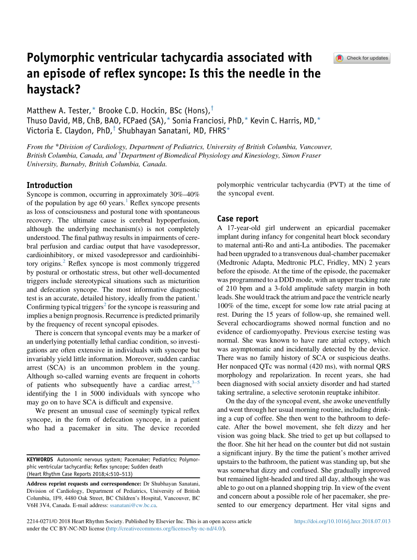 Pdf Polymorphic Ventricular Tachycardia Associated With An Episode Of Reflex Syncope Is This The Needle In The Haystack