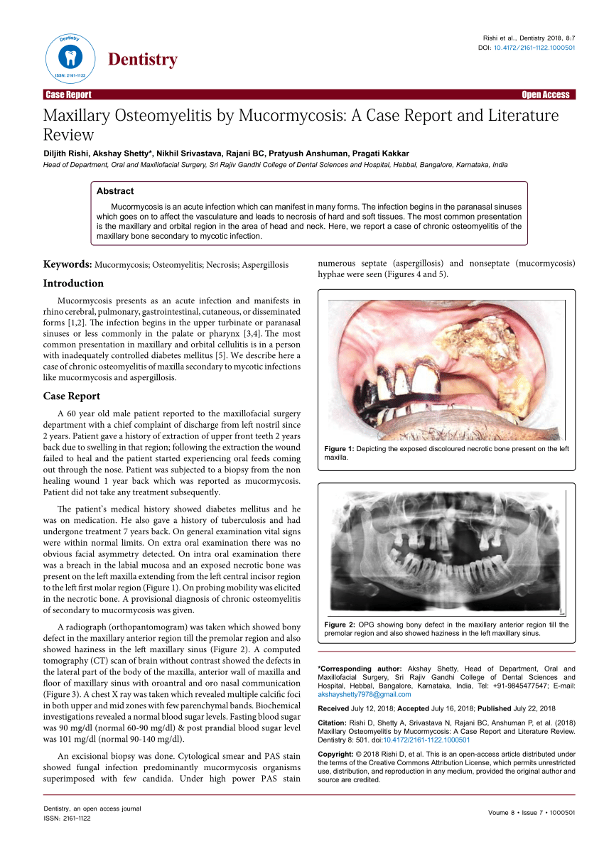 PDF) Maxillary Osteomyelitis by Mucormycosis: A Case Report and