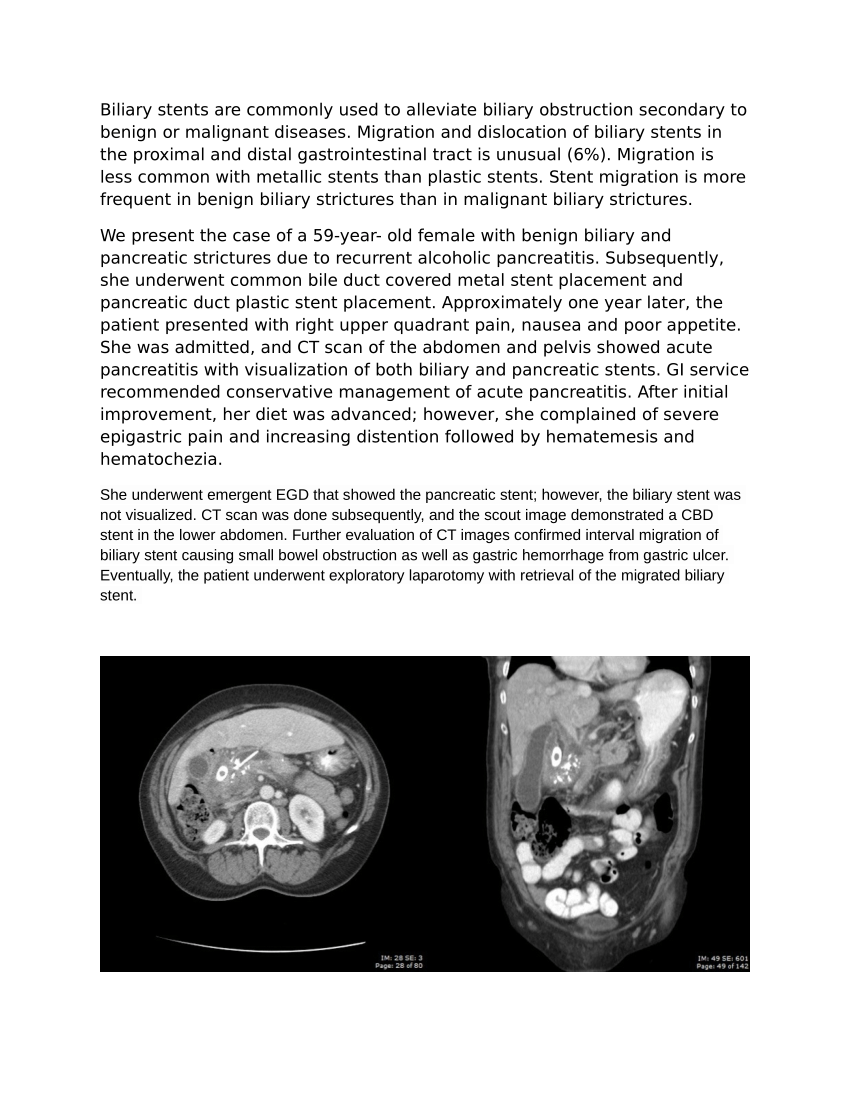 (PDF) Migrated biliary stent causing small bowel obstruction. ACR case