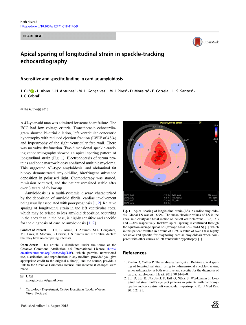 Figure 4 from The Imaging Diagnosis of Less Advanced Cases of Cardiac  Amyloidosis: The Relative Apical Sparing Pattern