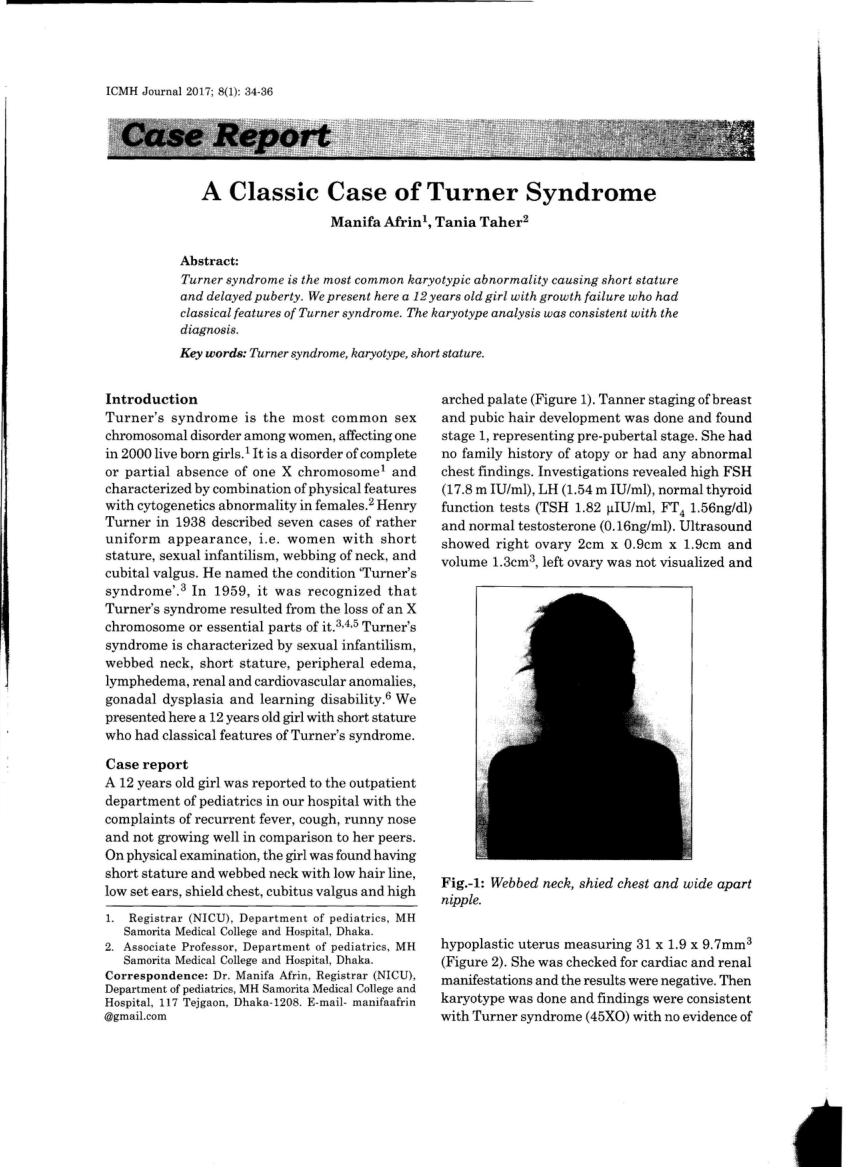 turner syndrome pdf info