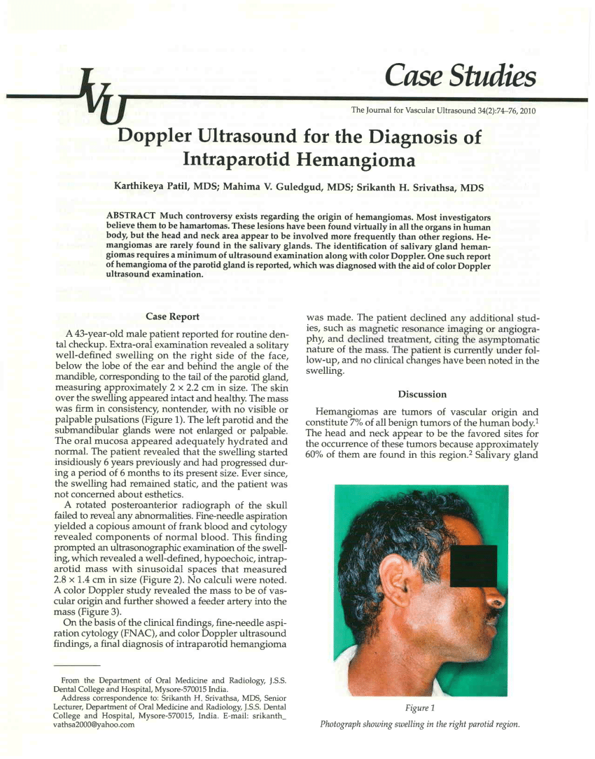 (PDF) Doppler Ultrasound for the Diagnosis of Intraparotid Parotid ...