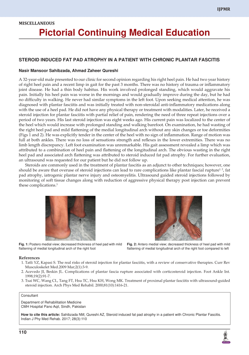 Management of painful plantar fat pad atrophy | Lower Extremity Review  Magazine