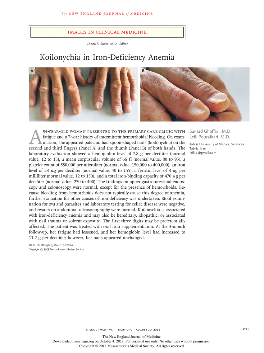 What Do Your Nails Say About Your Health? Signs Of Nutrient Deficiencies -  ReNue Rx