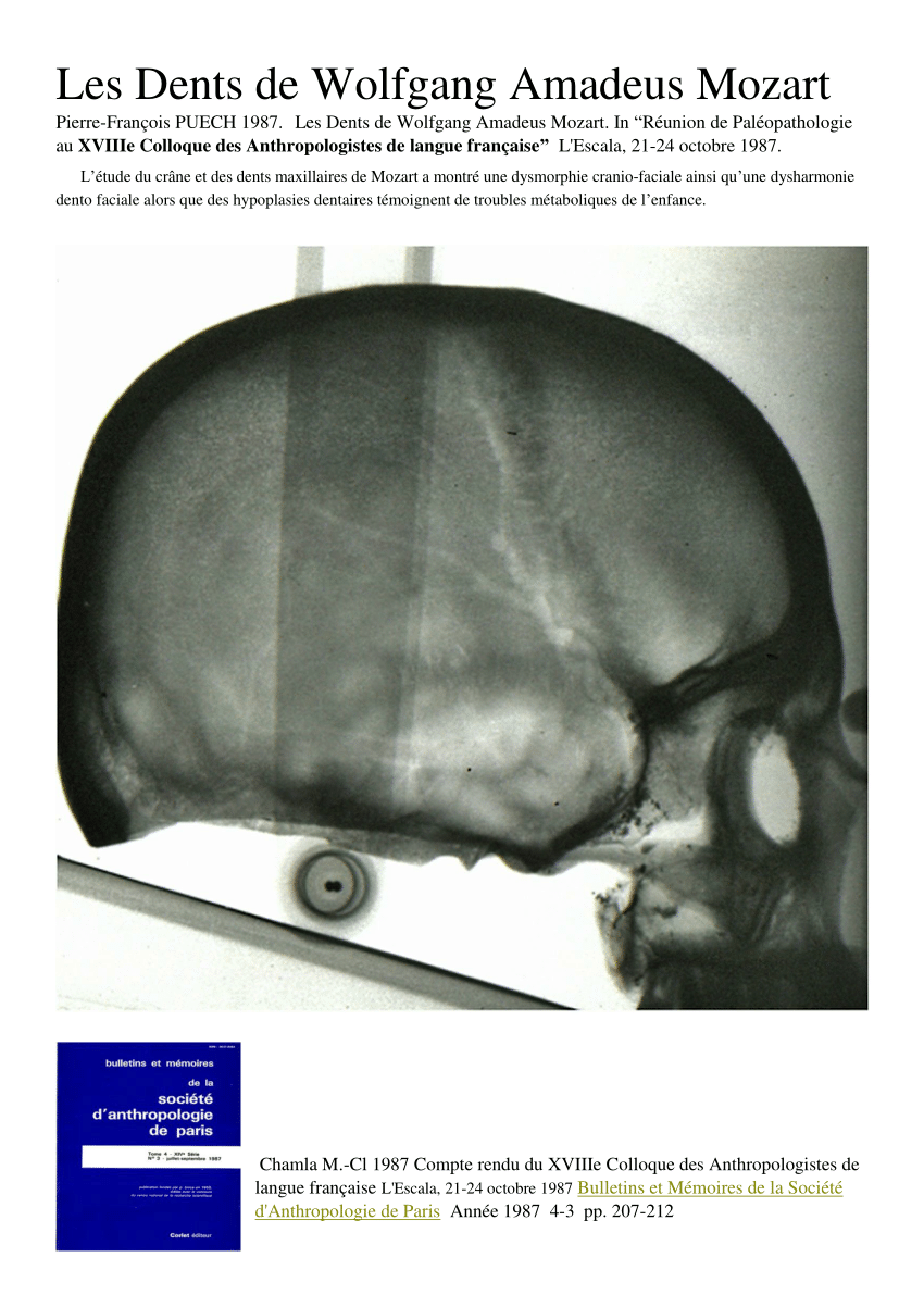 Pdf Les Dents De Wolfgang Amadeus Mozart