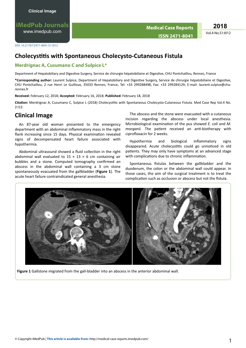 Pdf Cholecystitis With Spontaneous Cholecysto Cutaneous Fistula