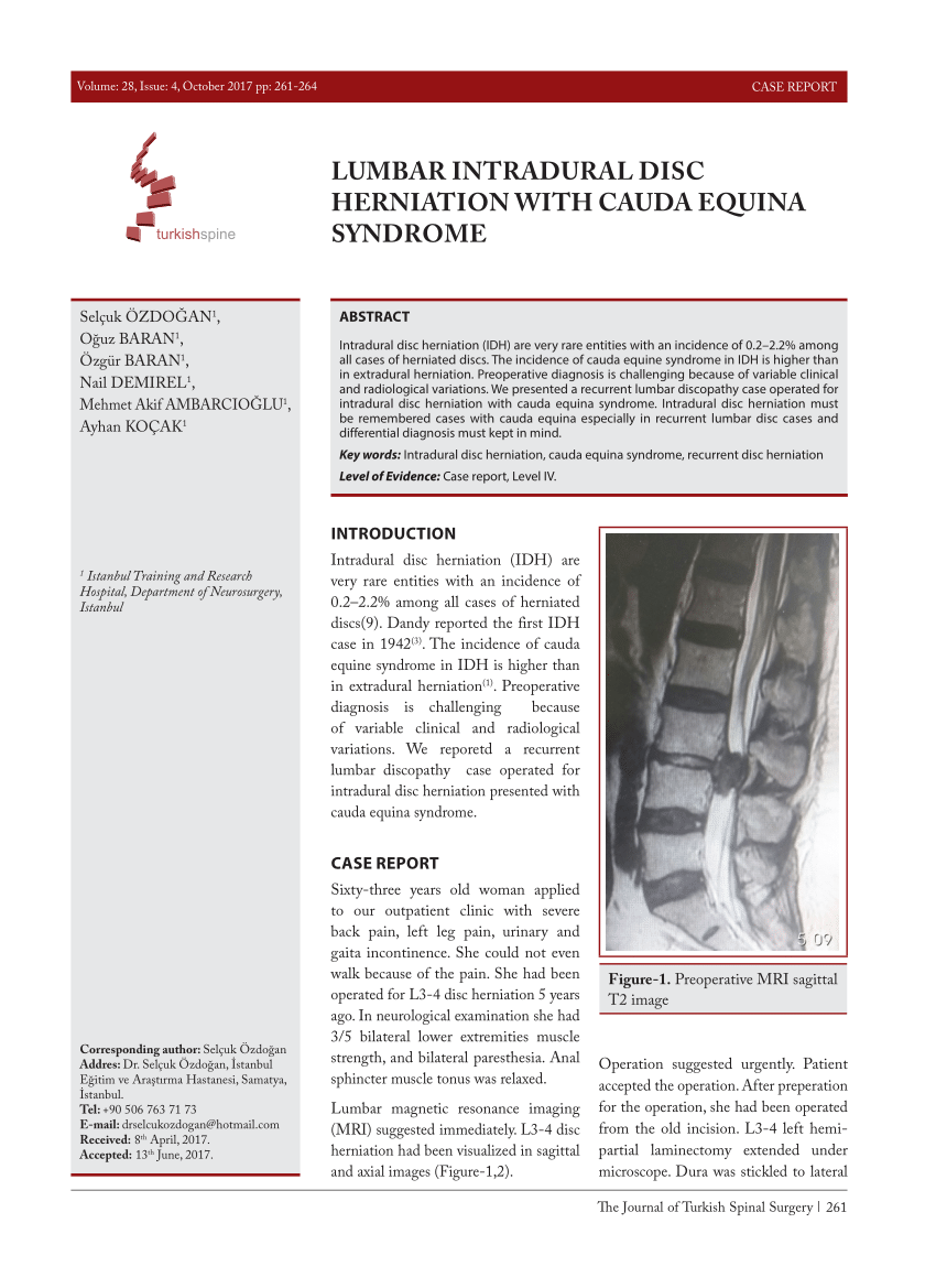 Pdf Lumbar Intradural Disc Herniation With Cauda Equina Syndrome 0849