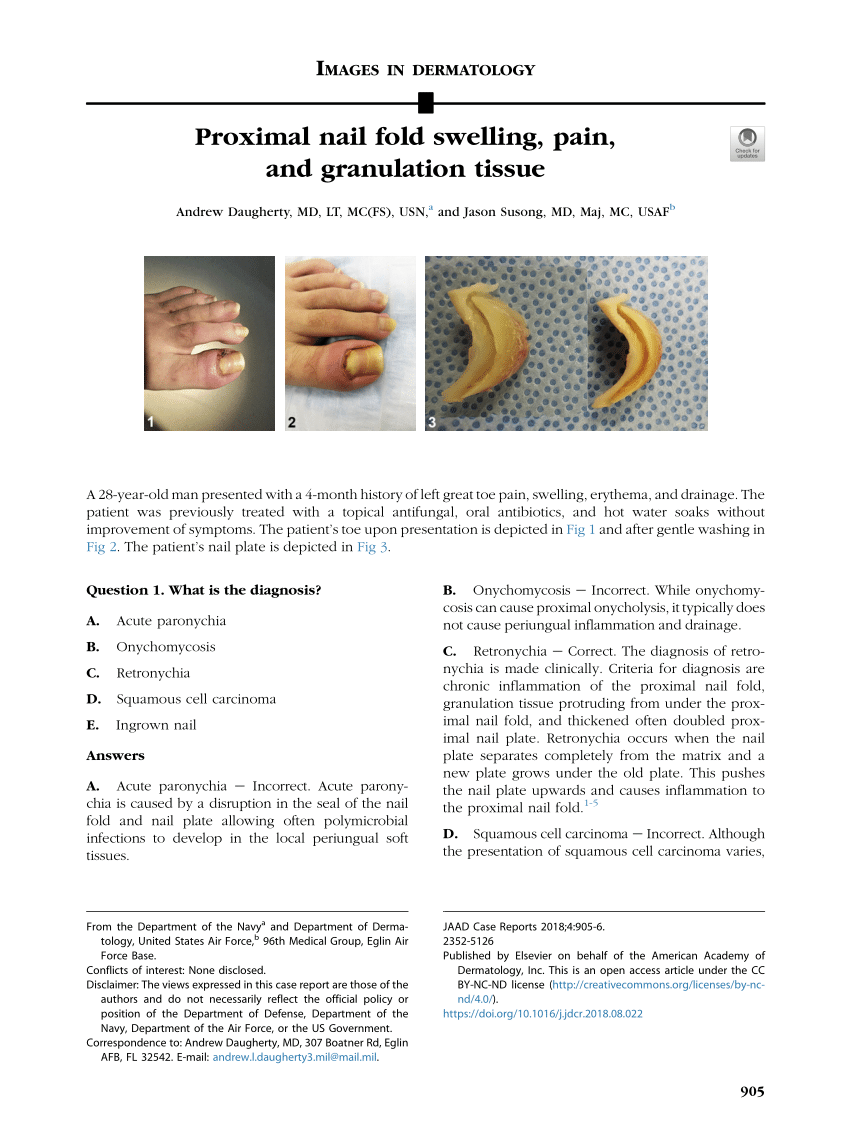 PDF) Proximal nail fold swelling, pain, and granulation tissue