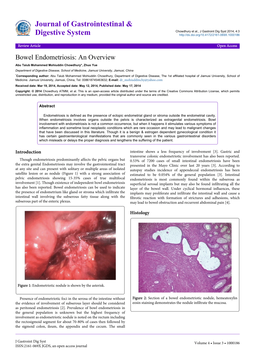 thesis on endometriosis pdf