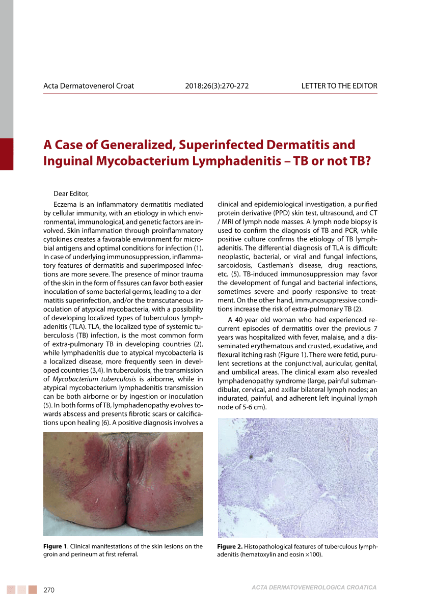 patient case study lymphadenitis