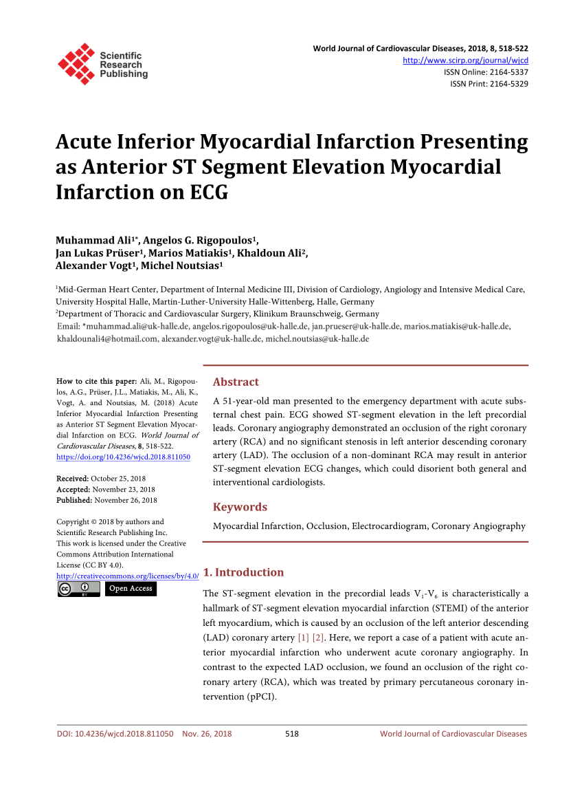 research article of myocardial infarction