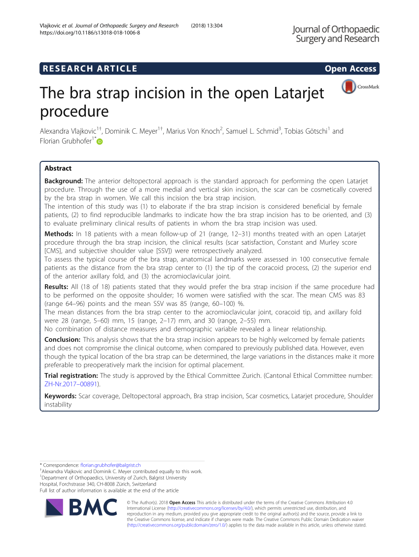 The bra strap incision in the open Latarjet procedure