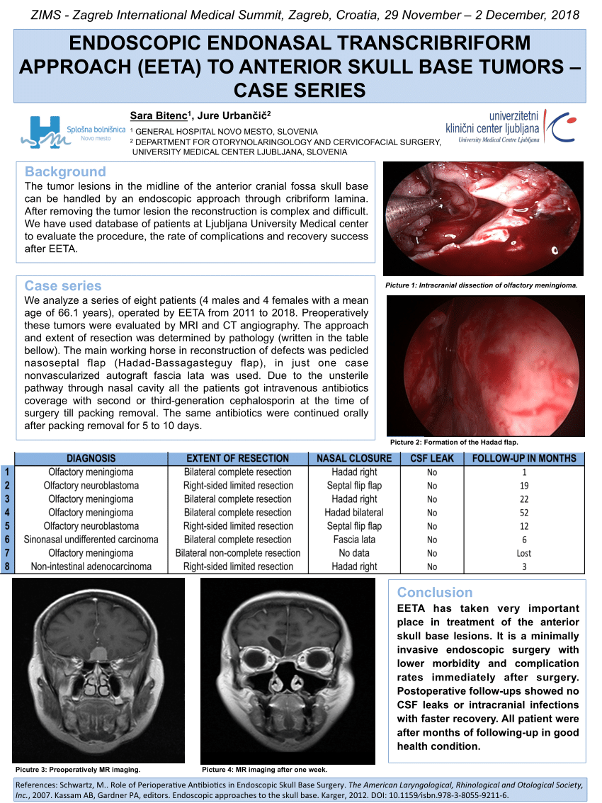 Pdf Endoscopic Endonasal Transcribriform Approach Eeta To Anterior Skull Base Tumors Case Series 