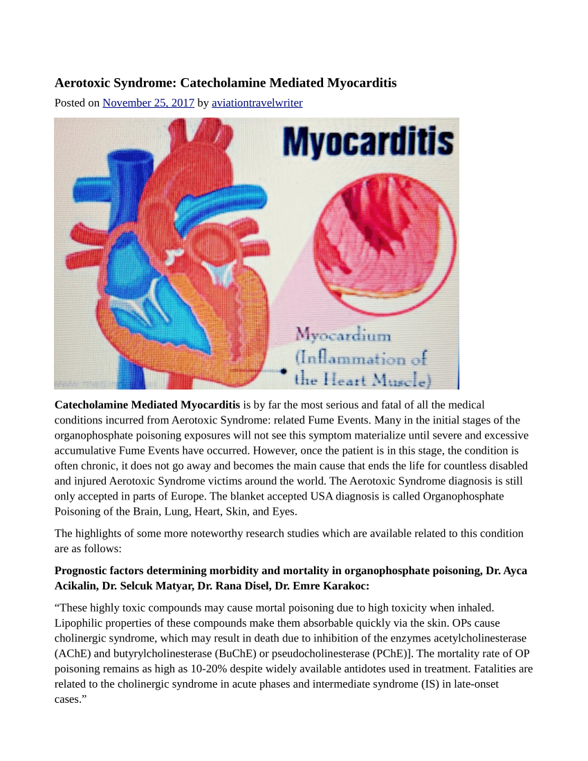 myocarditis - photo #30