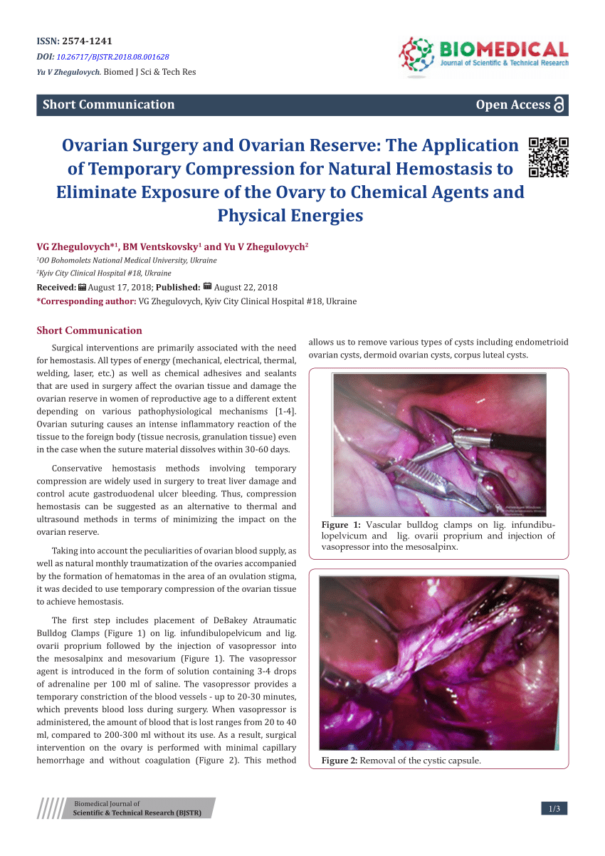 PDF) Ovarian Surgery and Ovarian Reserve: The Application of Temporary  Compression for Natural Hemostasis to Eliminate Exposure of the Ovary to  Chemical Agents and Physical Energies