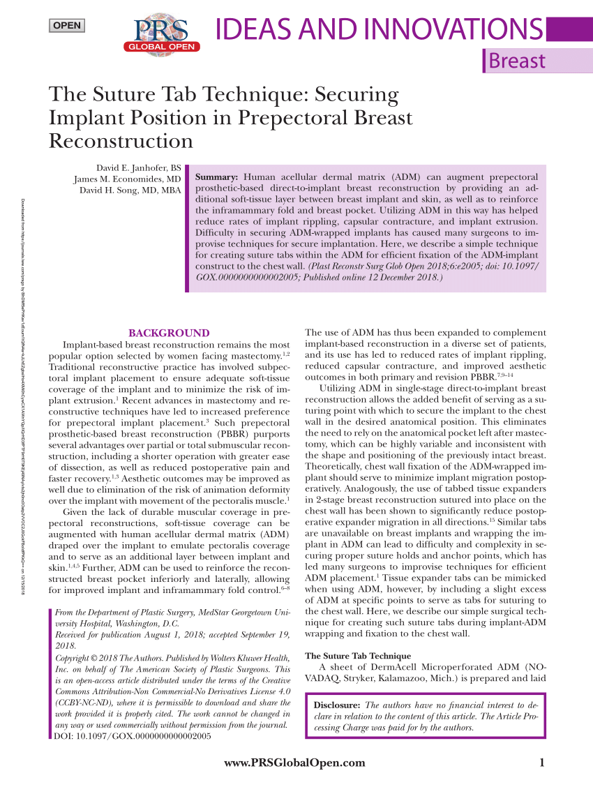 Pdf The Suture Tab Technique Securing Implant Position In Prepectoral Breast Reconstruction 