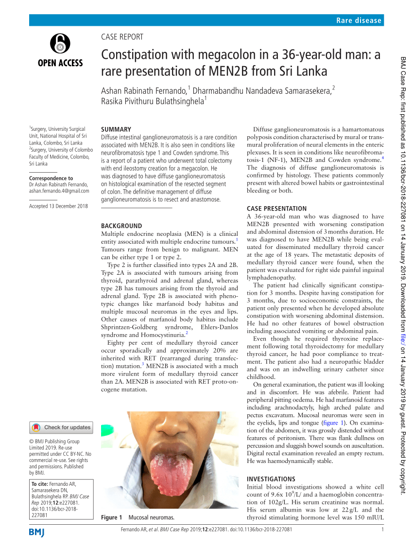 Pdf Constipation With Megacolon In A 36 Year Old Man A Rare Presentation Of Men2b From Sri Lanka