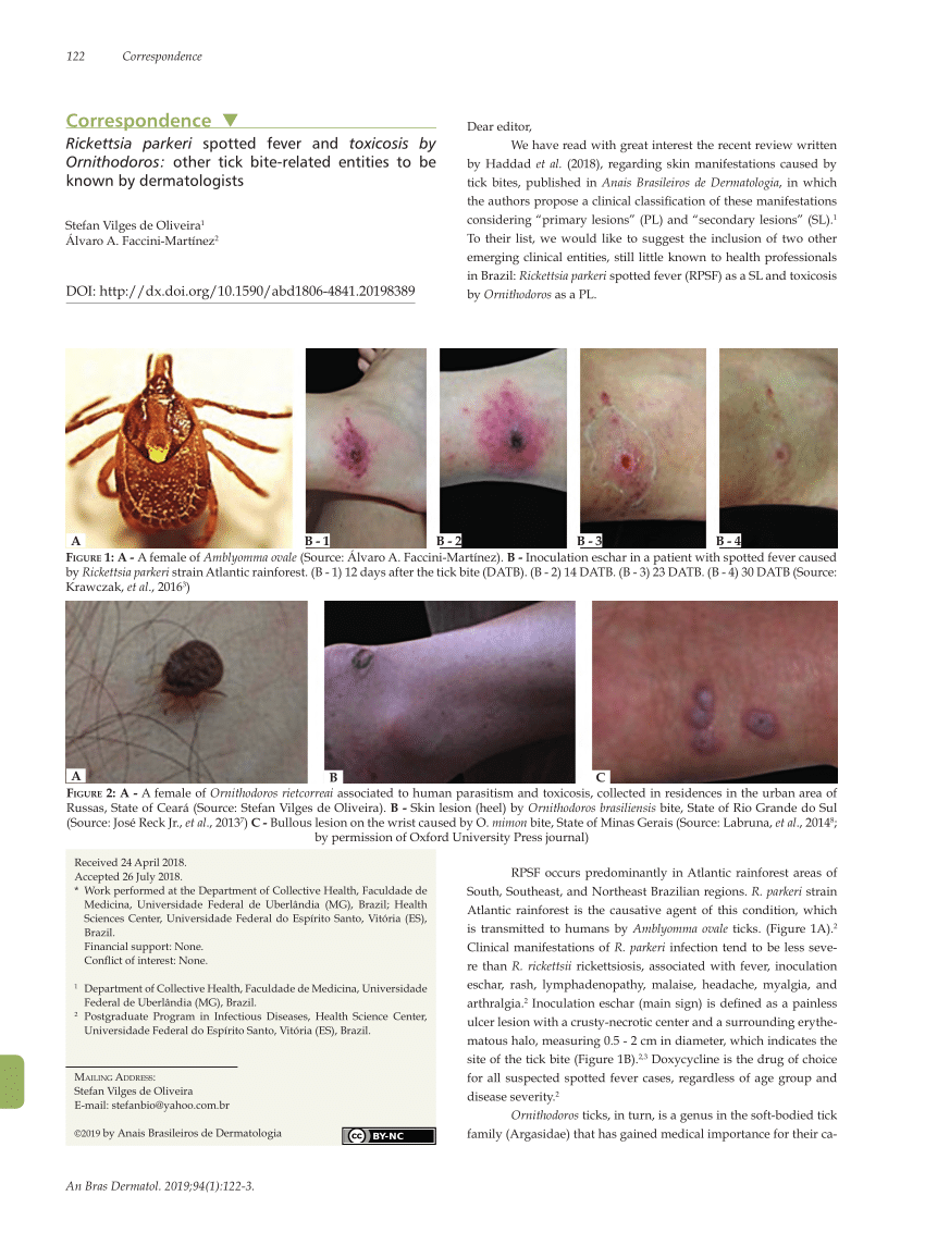 (PDF) Rickettsia parkeri spotted fever and toxicosis by Ornithodoros ...