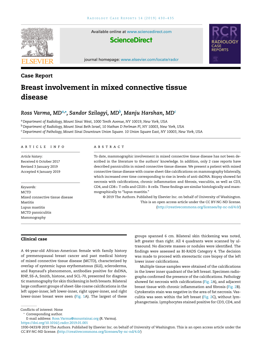Breast involvement in mixed connective tissue disease - ScienceDirect