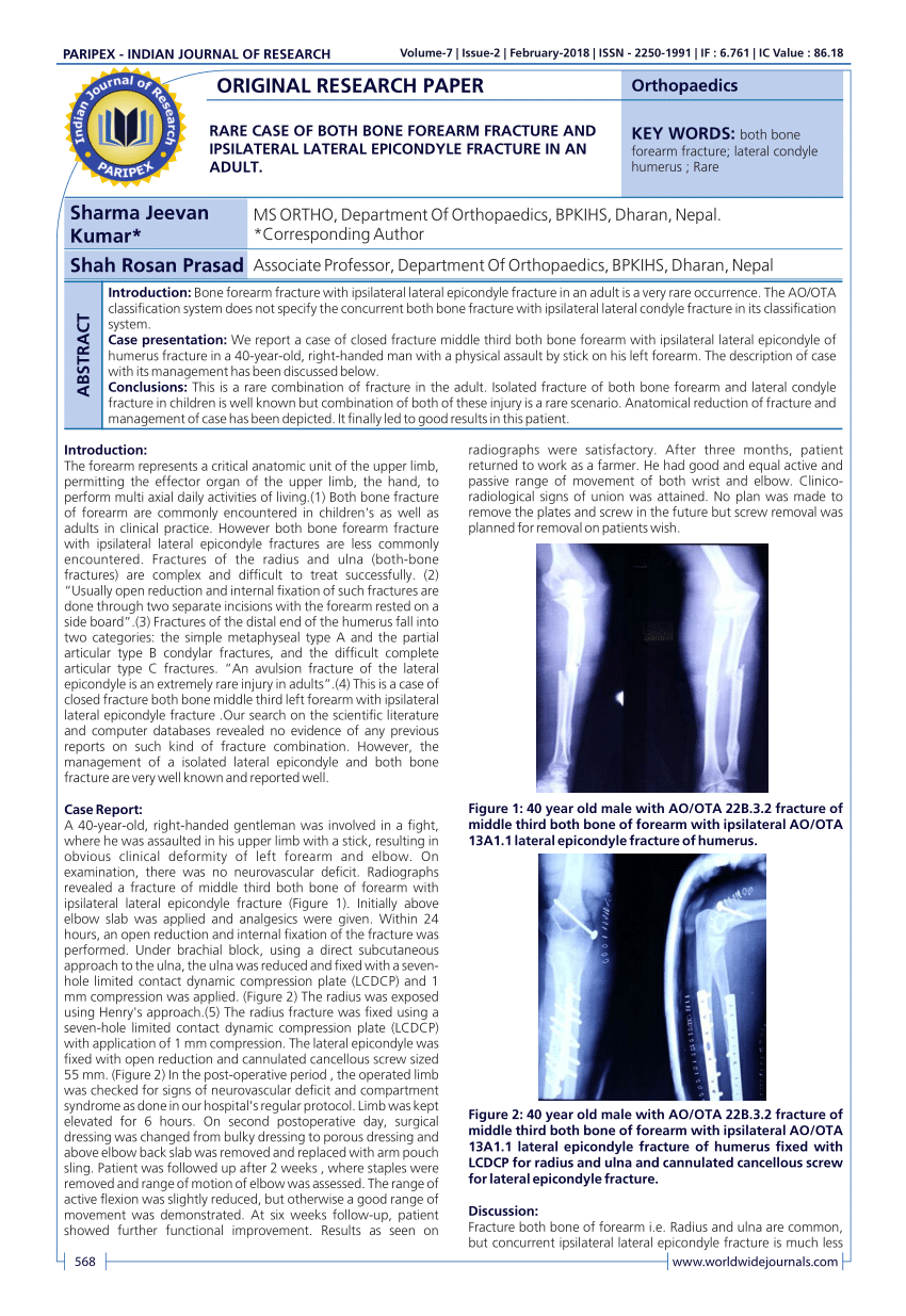 Pdf Rare Case Of Both Bone Forearm Fracture And Ipsilateral Lateral Epicondyle Fracture In An