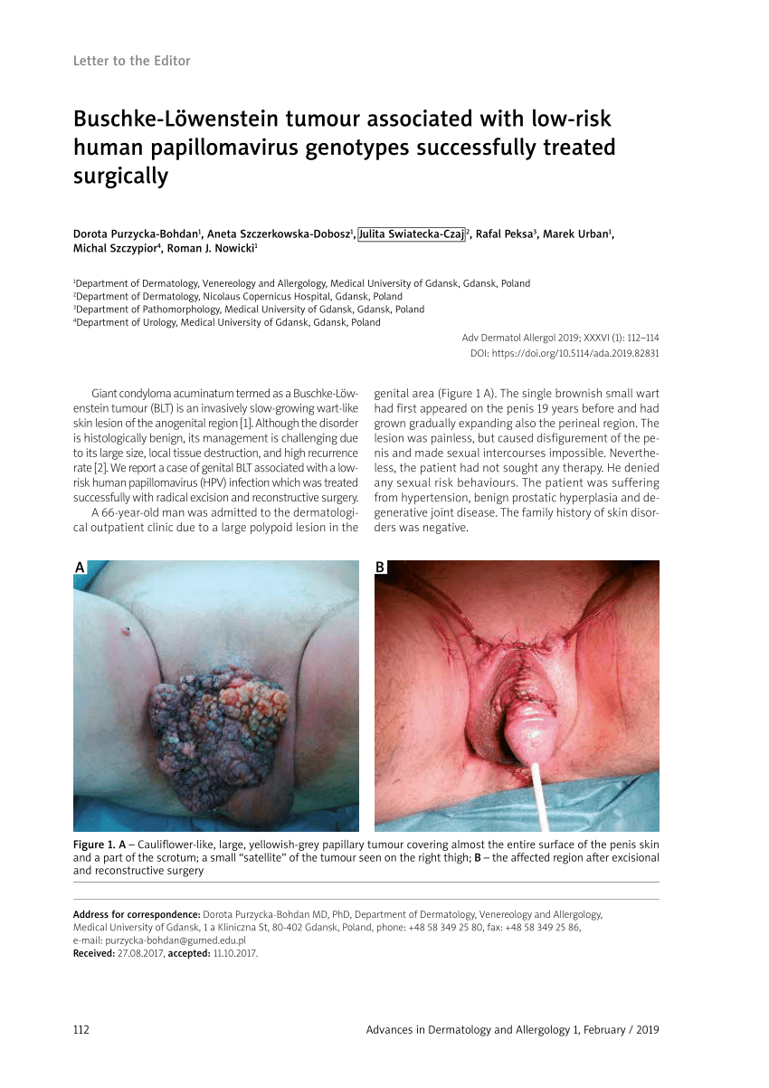 operation lesion papillomavirus