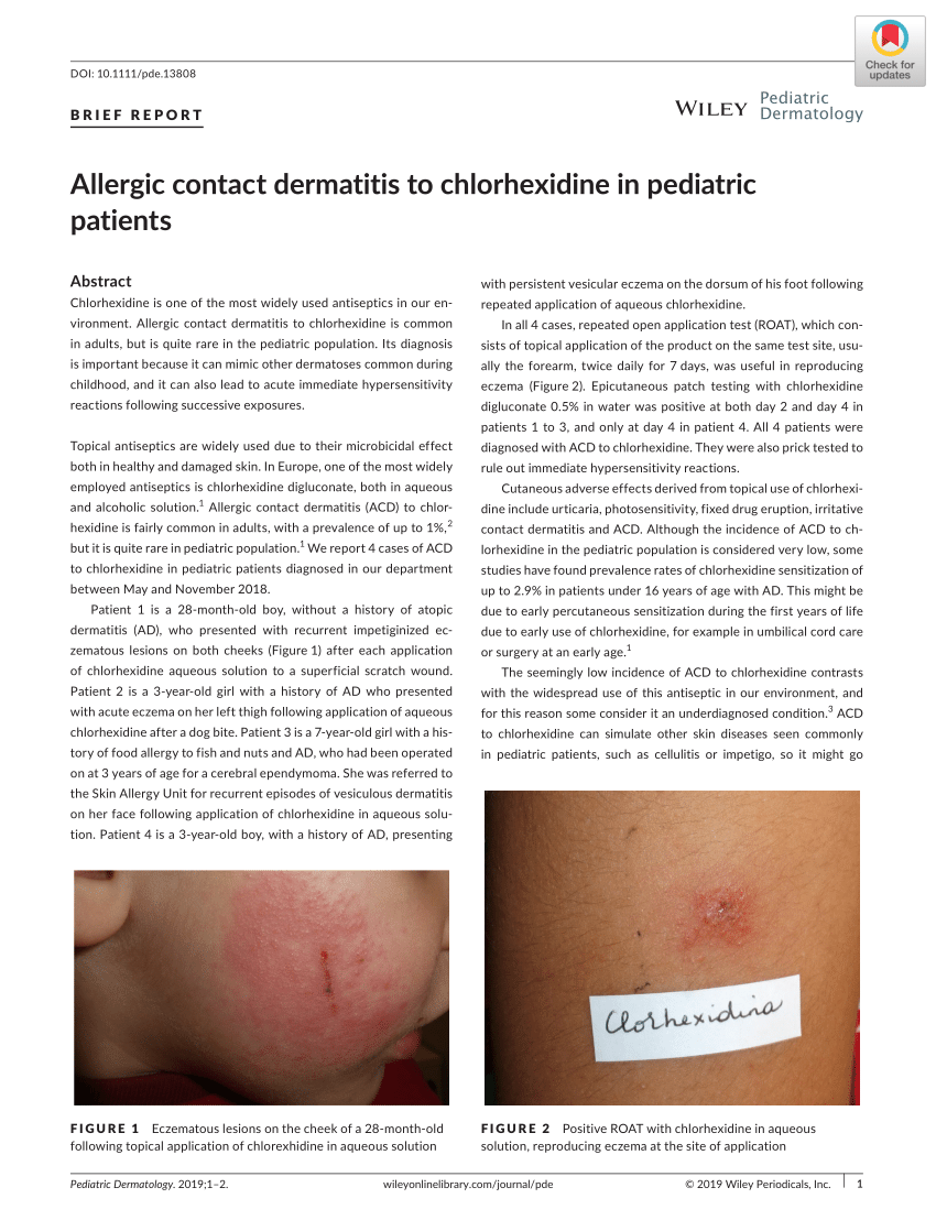 Pdf Allergic Contact Dermatitis To Chlorhexidine In Pediatric Patients