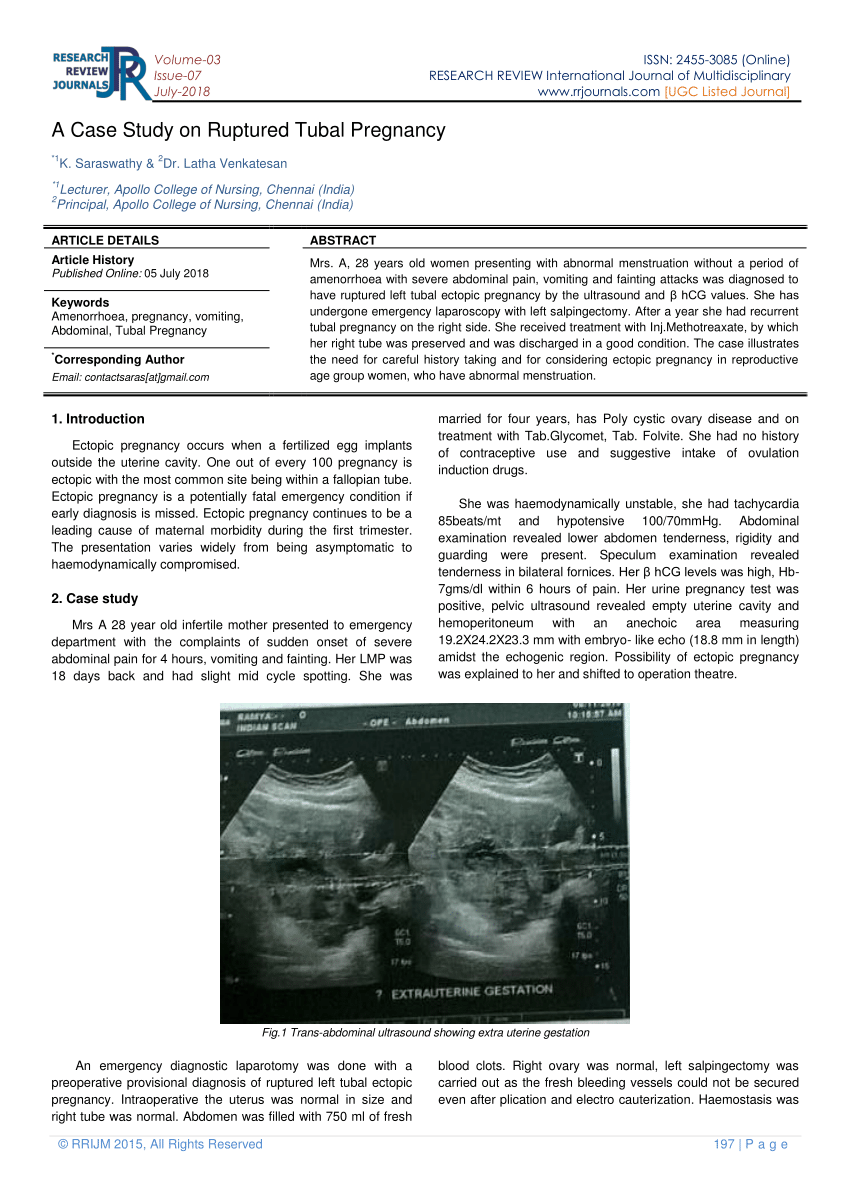 ectopic pregnancy case study pdf