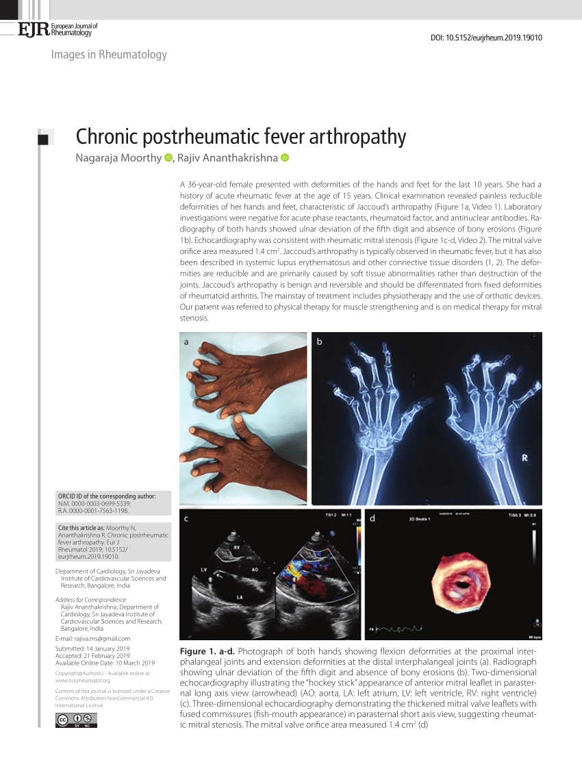 Pdf Chronic Postrheumatic Fever Arthropathy