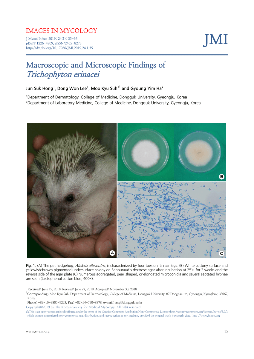 Inflammatory Tinea Manuum due to Trichophyton Erinacei from a Hedgehog: A  Case Report and Review of the Literature