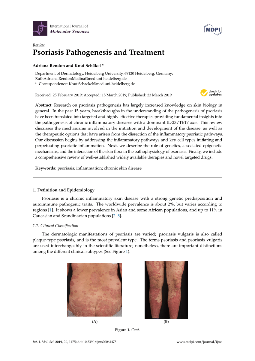 diagnosis psoriasis vulgaris pdf)