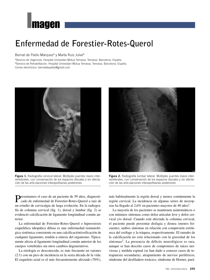 Pdf Enfermedad De Forestier Rotes Querol