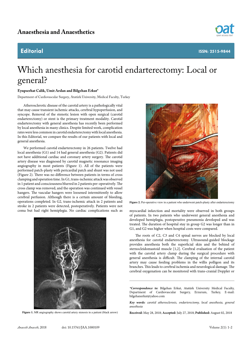 General anaesthesia versus local anaesthesia for carotid surgery