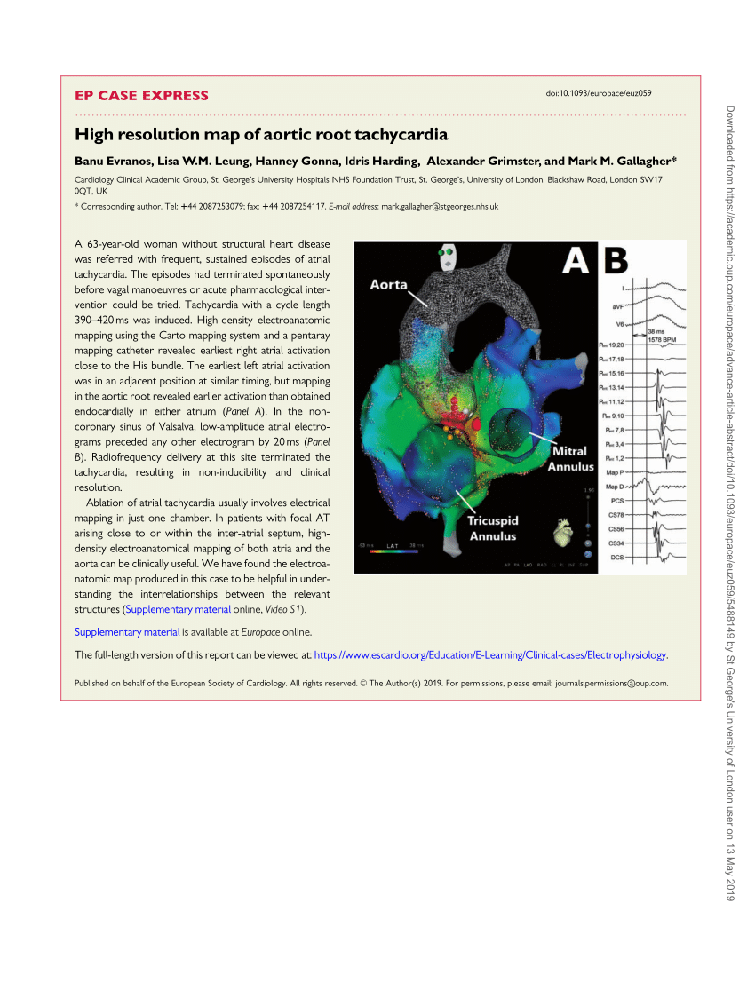 Pdf Ep Case Express High Resolution Map Of Aortic Root