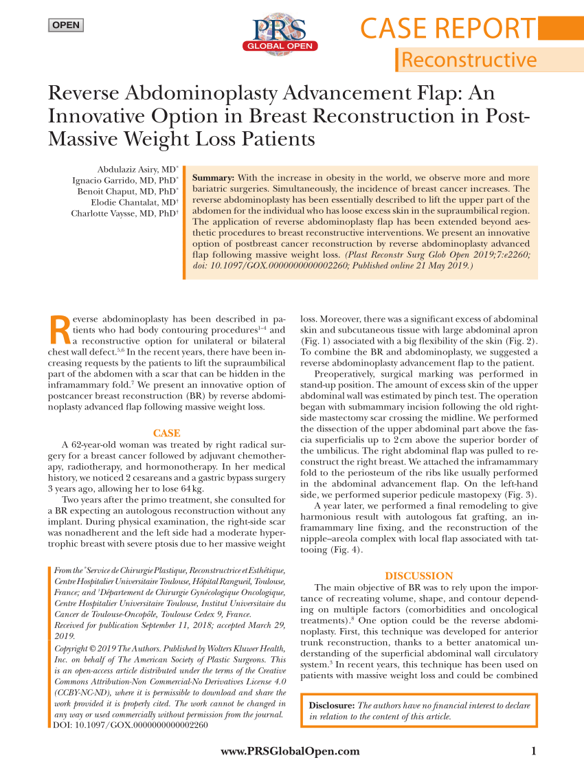 PDF] Breast reconstruction with reverse mini abdominoplasty