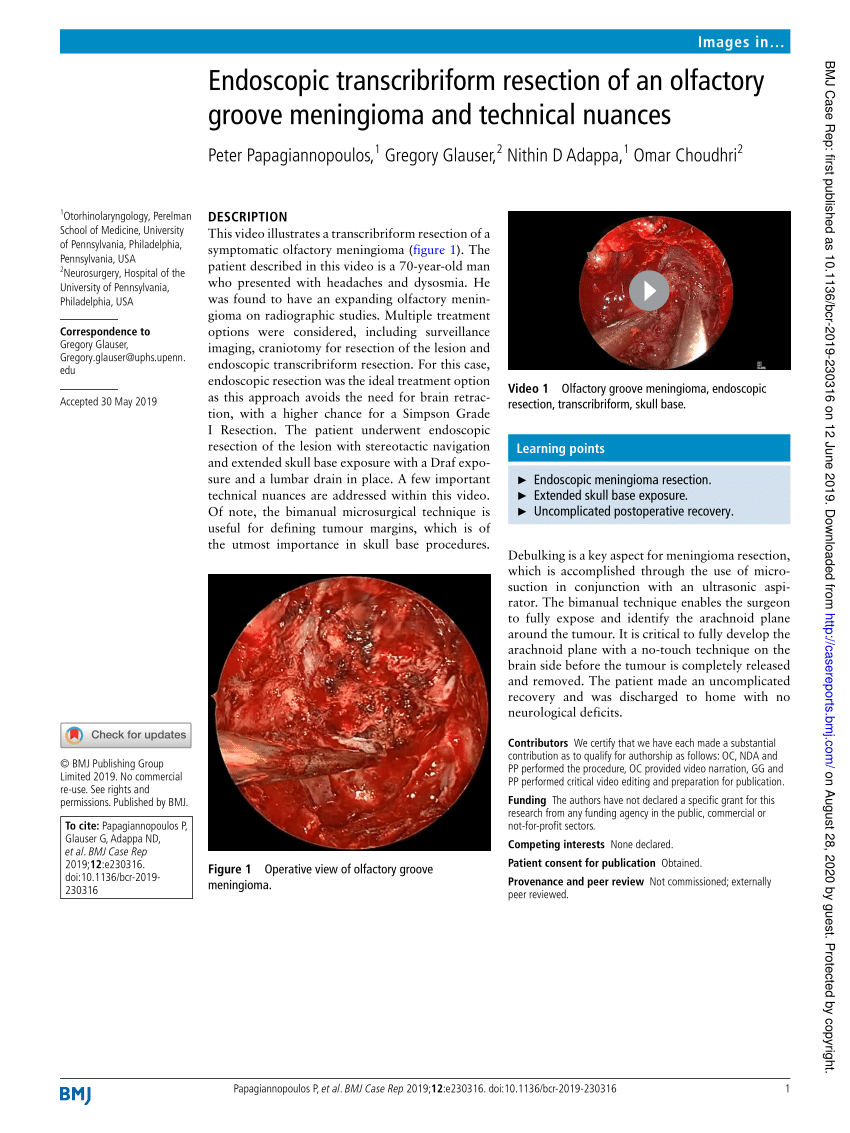 Pdf Endoscopic Transcribriform Resection Of An Olfactory Groove Meningioma And Technical Nuances 